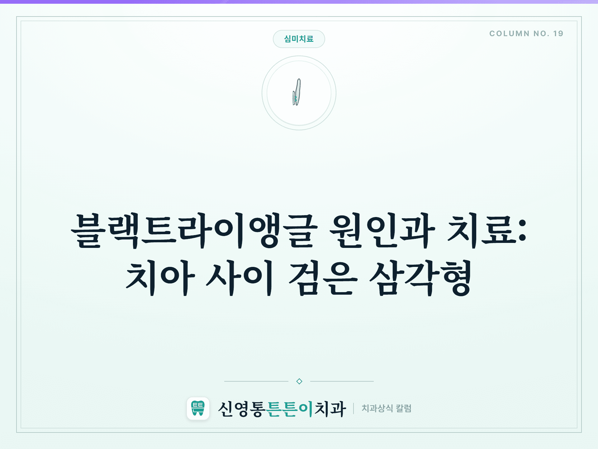 블랙트라이앵글 원인과 치료: 치아 사이 검은 삼각형