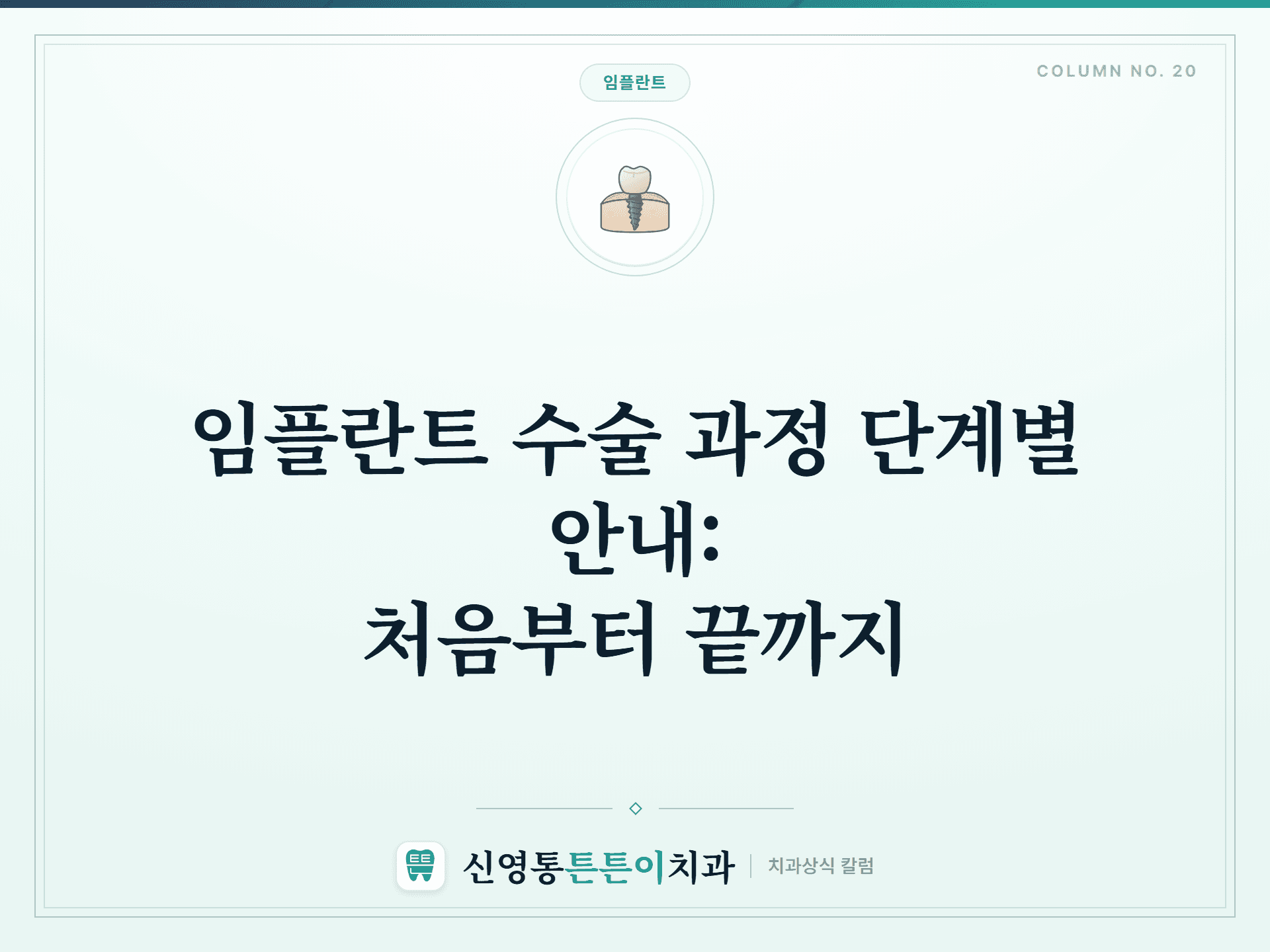 임플란트 수술 과정 단계별 안내: 처음부터 끝까지 썸네일