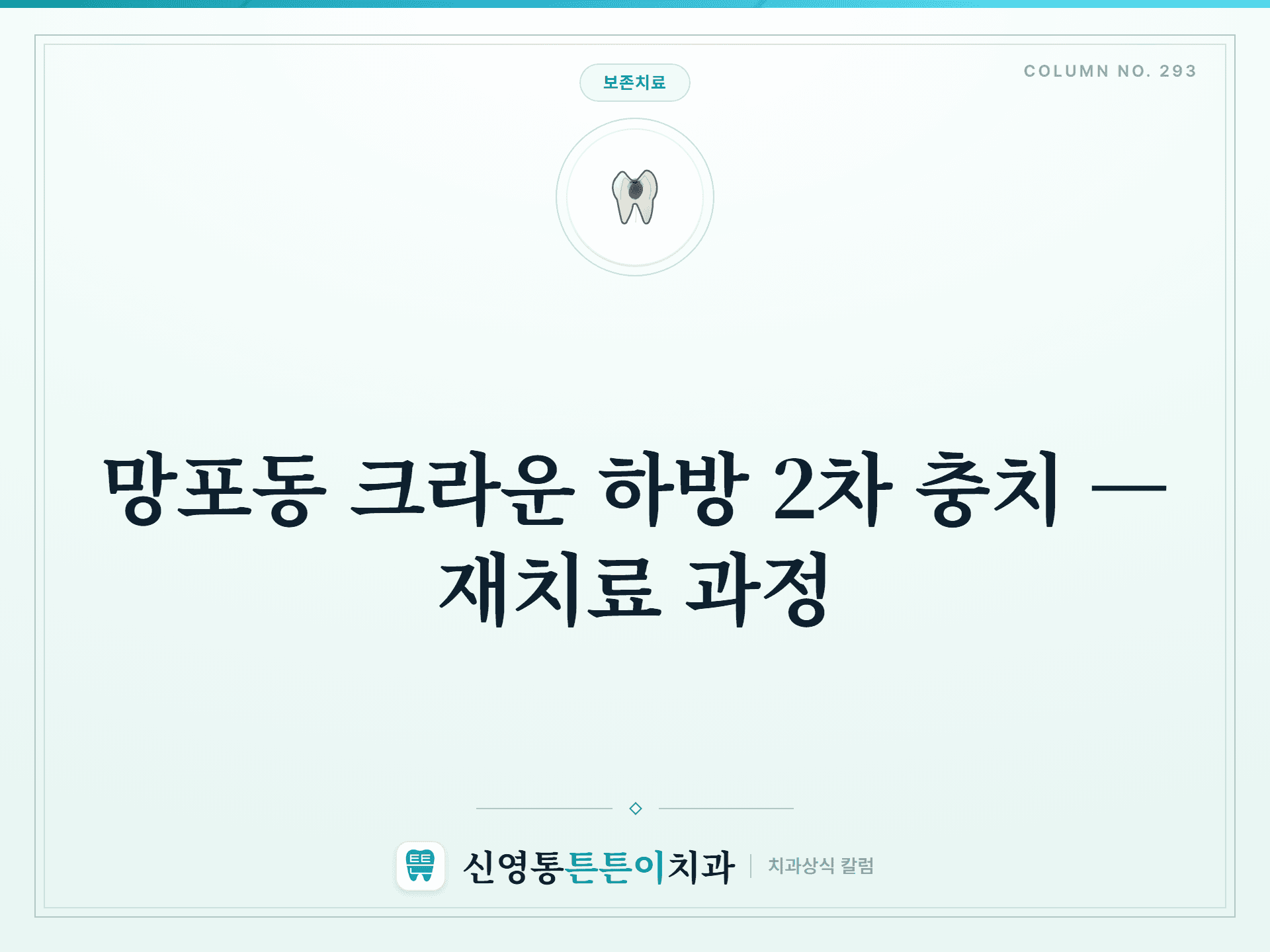 망포동 크라운 하방 2차 충치 — 재치료 과정