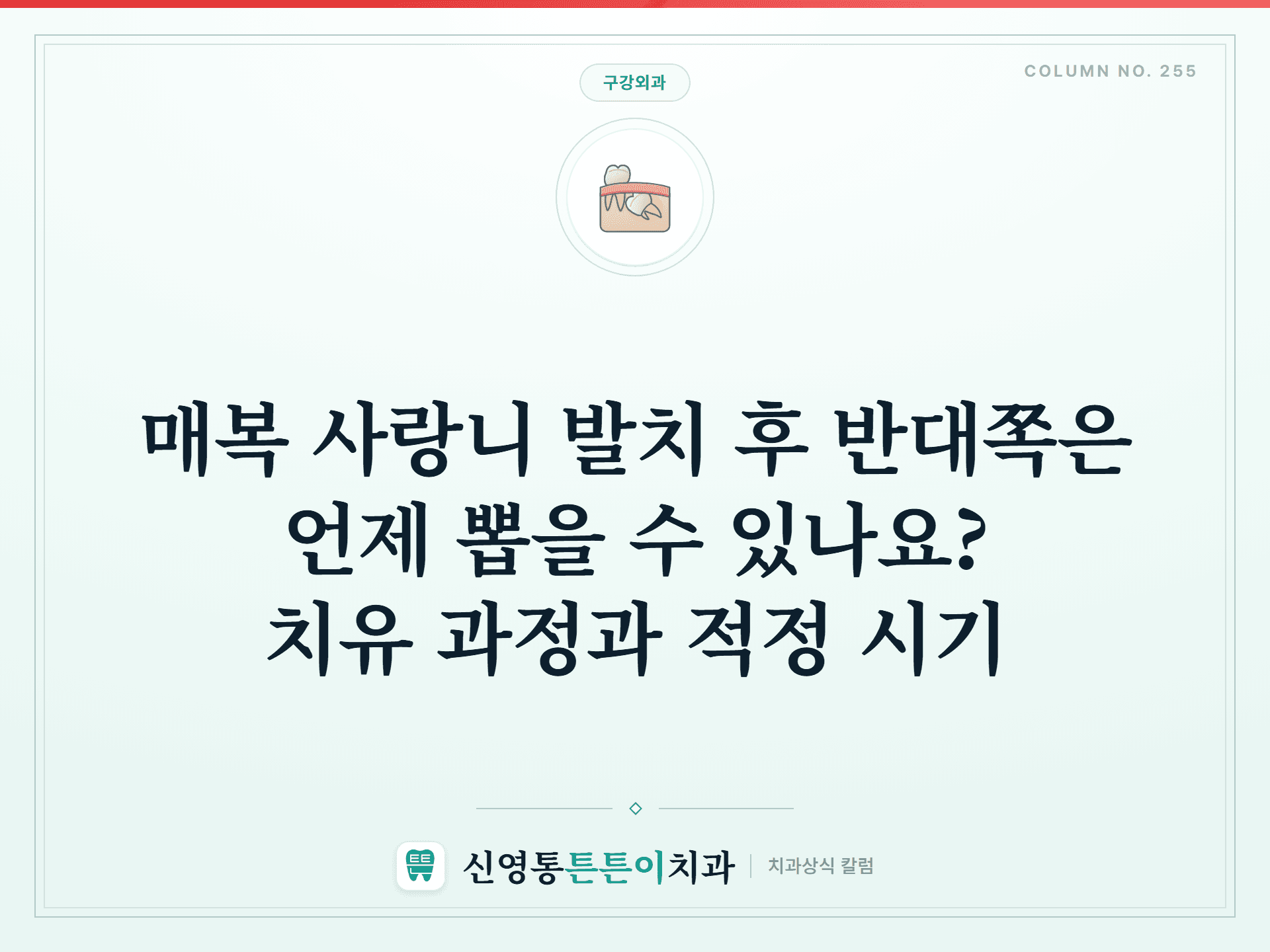 매복 사랑니 발치 후 반대쪽은 언제 뽑을 수 있나요? 치유 과정과 적정 시기