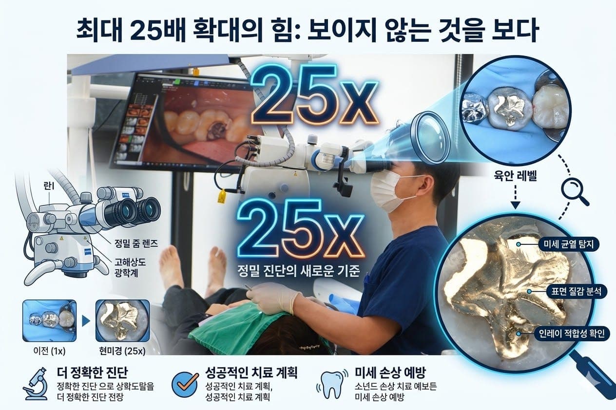 레진 빌드업 치료 - 자연치아를 지키는 심미 치료